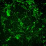 PSD-95 Antibody in Immunocytochemistry (ICC/IF)