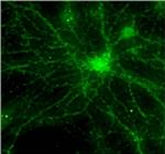 PSD-95 Antibody in Immunocytochemistry (ICC/IF)