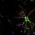 PSD-95 Antibody in Immunocytochemistry (ICC/IF)