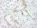 PSF/SFPQ Antibody in Immunohistochemistry (IHC)