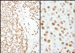 PSF/SFPQ Antibody in Immunohistochemistry (IHC)