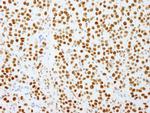 PSF/SFPQ Antibody in Immunohistochemistry (IHC)