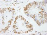 PSF/SFPQ Antibody in Immunohistochemistry (IHC)