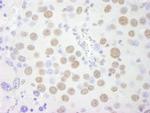 PSF/SFPQ Antibody in Immunohistochemistry (IHC)