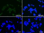 PSMA1 Antibody in Immunocytochemistry (ICC/IF)