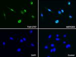 PSMA1 Antibody in Immunocytochemistry (ICC/IF)