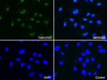 PSMA1 Antibody in Immunocytochemistry (ICC/IF)