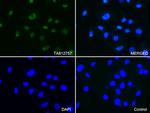 PSMA1 Antibody in Immunocytochemistry (ICC/IF)