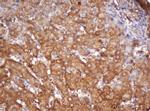 PSMA2 Antibody in Immunohistochemistry (Paraffin) (IHC (P))