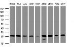 PSMA2 Antibody in Western Blot (WB)