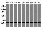 PSMA2 Antibody in Western Blot (WB)