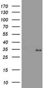 PSMA4 Antibody in Western Blot (WB)