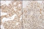 PSMA5 Antibody in Immunohistochemistry (IHC)