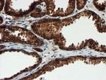 PSMA6 Antibody in Immunohistochemistry (Paraffin) (IHC (P))