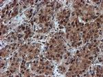 PSMA6 Antibody in Immunohistochemistry (Paraffin) (IHC (P))