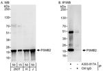 PSMB2 Antibody in Western Blot (WB)