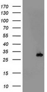 PSMB4 Antibody in Western Blot (WB)