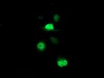 PSMB7 Antibody in Immunocytochemistry (ICC/IF)