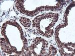 PSMB7 Antibody in Immunohistochemistry (Paraffin) (IHC (P))