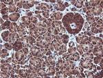 PSMB7 Antibody in Immunohistochemistry (Paraffin) (IHC (P))