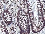 PSMB7 Antibody in Immunohistochemistry (Paraffin) (IHC (P))