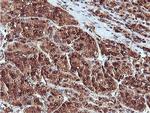 PSMB7 Antibody in Immunohistochemistry (Paraffin) (IHC (P))