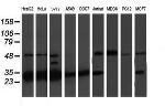 PSMB7 Antibody in Western Blot (WB)