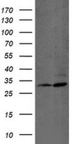 PSMB7 Antibody in Western Blot (WB)