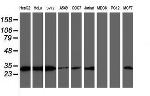 PSMB7 Antibody in Western Blot (WB)