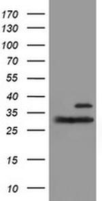 PSMB7 Antibody in Western Blot (WB)