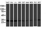 PSMB7 Antibody in Western Blot (WB)