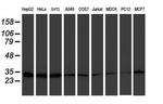 PSMB7 Antibody in Western Blot (WB)