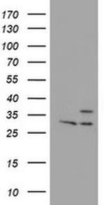 PSMB7 Antibody in Western Blot (WB)