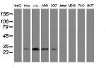 PSMB7 Antibody in Western Blot (WB)