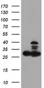 PSMB7 Antibody in Western Blot (WB)