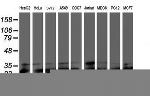 PSMB7 Antibody in Western Blot (WB)