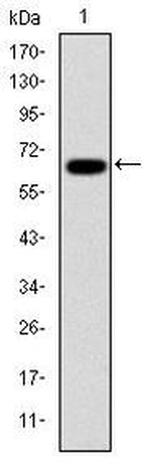 PSMB8 Antibody in Western Blot (WB)