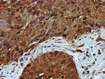 PSMB9 Antibody in Immunohistochemistry (Paraffin) (IHC (P))