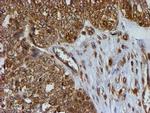 PSMB9 Antibody in Immunohistochemistry (Paraffin) (IHC (P))