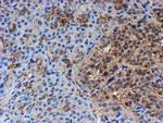 PSMB9 Antibody in Immunohistochemistry (Paraffin) (IHC (P))