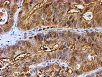 PSMB9 Antibody in Immunohistochemistry (Paraffin) (IHC (P))