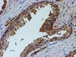 PSMB9 Antibody in Immunohistochemistry (Paraffin) (IHC (P))