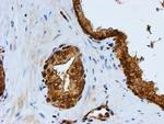 PSMB9 Antibody in Immunohistochemistry (Paraffin) (IHC (P))