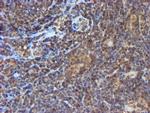 PSMB9 Antibody in Immunohistochemistry (Paraffin) (IHC (P))