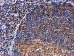 PSMB9 Antibody in Immunohistochemistry (Paraffin) (IHC (P))