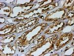 PSMB9 Antibody in Immunohistochemistry (Paraffin) (IHC (P))