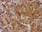 PSMB9 Antibody in Immunohistochemistry (Paraffin) (IHC (P))