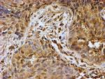 PSMB9 Antibody in Immunohistochemistry (Paraffin) (IHC (P))