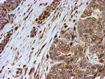 PSMB9 Antibody in Immunohistochemistry (Paraffin) (IHC (P))