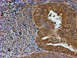 PSMB9 Antibody in Immunohistochemistry (Paraffin) (IHC (P))